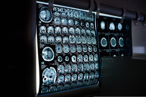 Die Zukunft der Neurotechnologien - Chancen und Risiken für unsere Gesellschaft